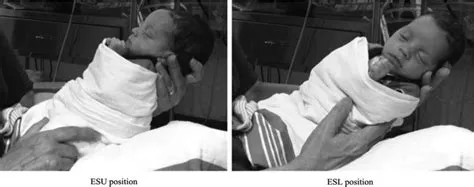 Efficacy of Semielevated Side-Lying Positioning During Bottl... : The ...