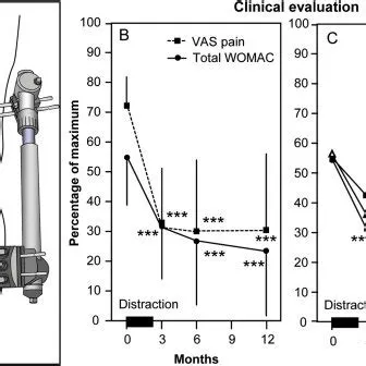 (A) Drawing of the monotubes placed on bone pins bridging the knee ...