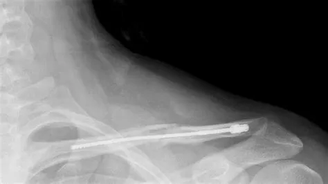 New Device Sparks Call for Innovation in Patient Care: Introducing the ...