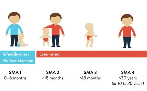 Understanding SMA