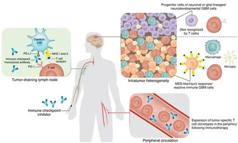 JCI - Immune checkpoint blockade in glioblastoma: from tumor ...