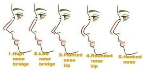 Nose types, Nose, Nose shapes