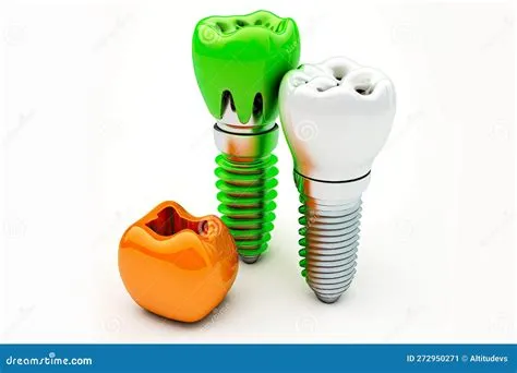 Samples of Dental Crowns with Different Pins for Dental Implantology ...