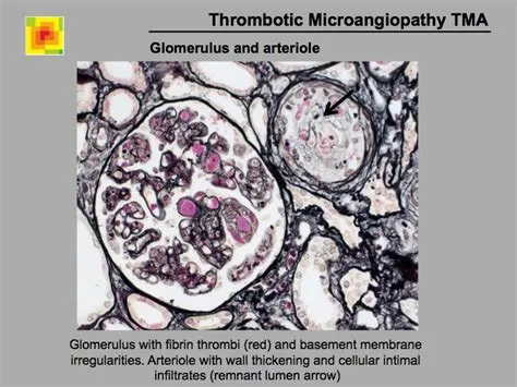 Glomerulus Slide