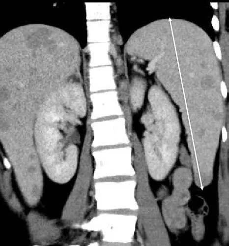 Anemi Flashcards | Quizlet