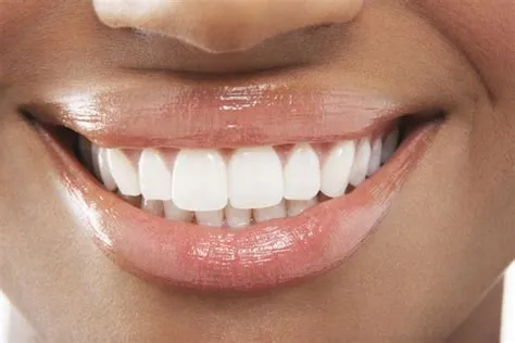 The Secret to a Bigger Smile - Michael J. Wei DDS PC