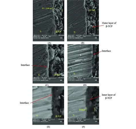 FESEM cross-section images of b-TCP coat layer. (A and B) at 5000X, (C ...