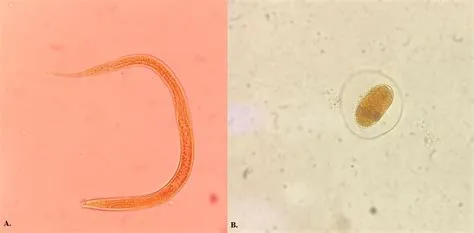 PHYSICAL WATER QUALITY CONTAMINATED BY SOIL-TRANSMITTED HELMINTHS IN ...