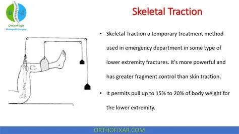Skeletal Traction Pin Insertion Sites at Ashley Smalley blog