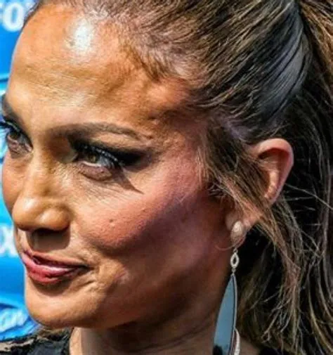 by Pinky on Cεlεвѕ | Plastic surgery, Celebrity surgery, Celebrities