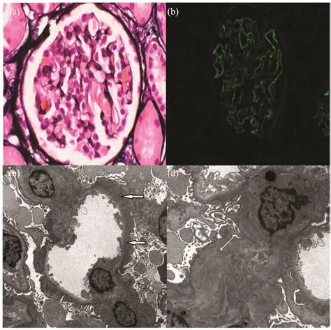 Glomerulus Slide