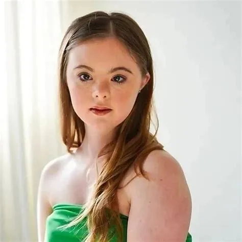 Top 45 Down Syndrome Influencers in 2025