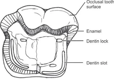 Fundamentals of Tooth Preparation Part 2 - Focus Dentistry