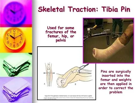 PPT - Traction PowerPoint Presentation, free download - ID:9539248