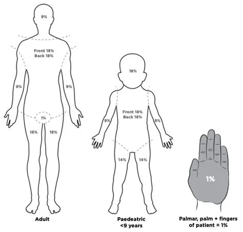 Clinical Practice Guidelines : Burns - Acute Management