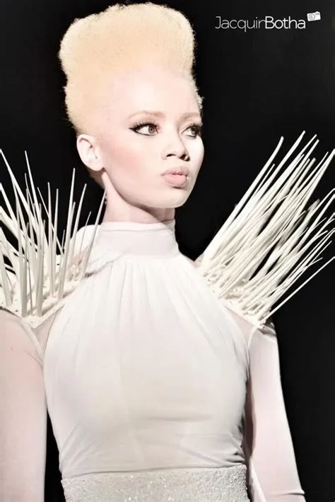 by Lora Palmer on Fitnes | Albino model, African models, African beauty