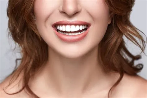 Healthy white smile close up. Beauty woman with perfect smile, lips and ...