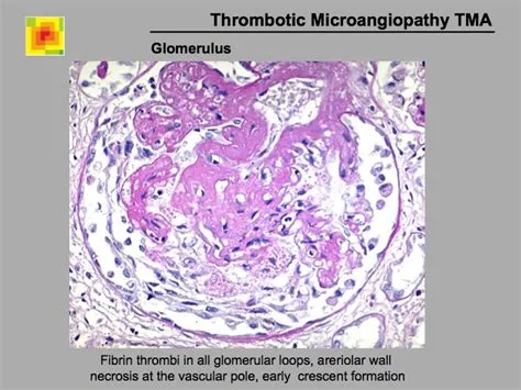 Glomerulus Slide