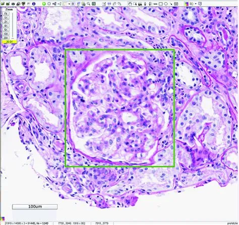 Glomerulus example labeled using Aperio ImageScope tool. | Download ...